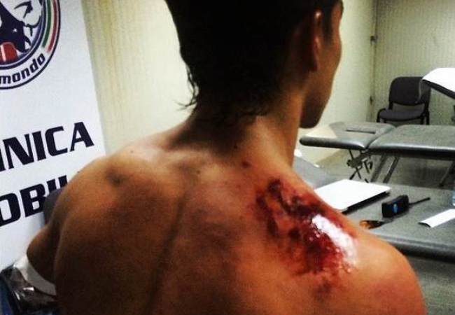 Así quedó Yonny Hernández luego de su accidente. Foto: Instagram