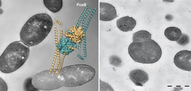 A la izquierda, imagen de los neumococos normales con la estructura de la proteina PcsB. A la derecha, unos neumococos sin esa proteína. Foto: EFE