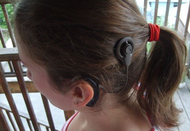 Nuevas tecnologías para problemas auditivos. Foto: EFE