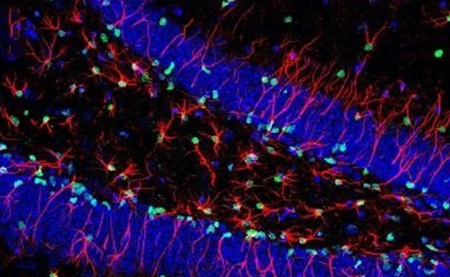 Células madre cerebrales implicadas en la producción de nuevas neuronas. Foto: EFE