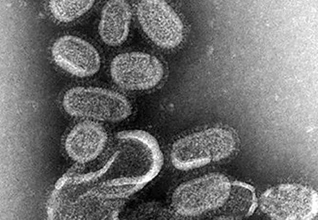 Imagen del virus de la gripe, cuyos síntomas son parecidos a los del síndrome de Sjögren. Foto: EFE