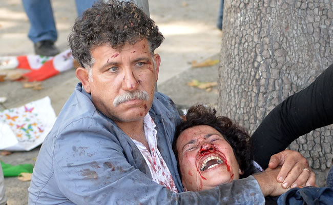 Atentado en Ankara deja más de 80 muertos. Foto: EFE