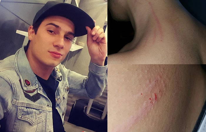 Pipe Bueno es agredido durante concierto. Foto: Instagram