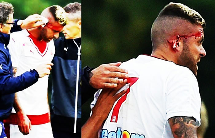 Ménez perdió su oreja en un partido amistoso. Foto: Twitter