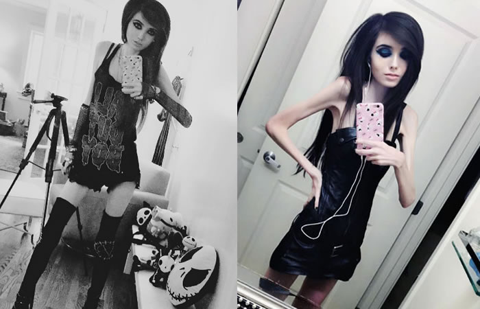Youtuber estaría induciendo a la anorexia. Foto: Instagram