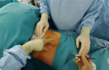 Snapchat: Médico transmitió en vivo cirugía usando las gafas de la App