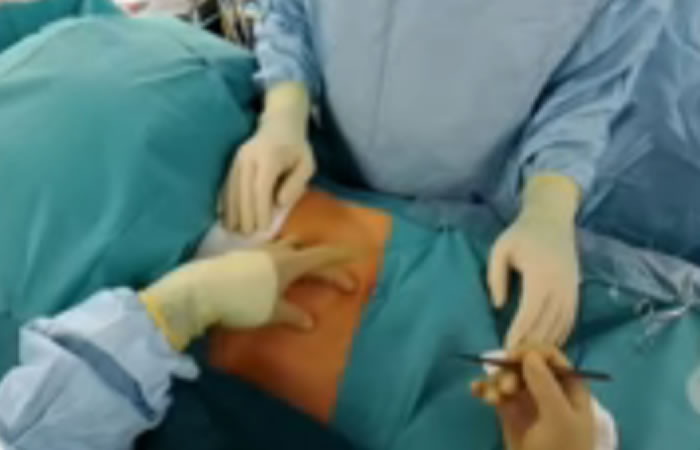 Doctor transmite en directo cirugía. Foto: Youtube
