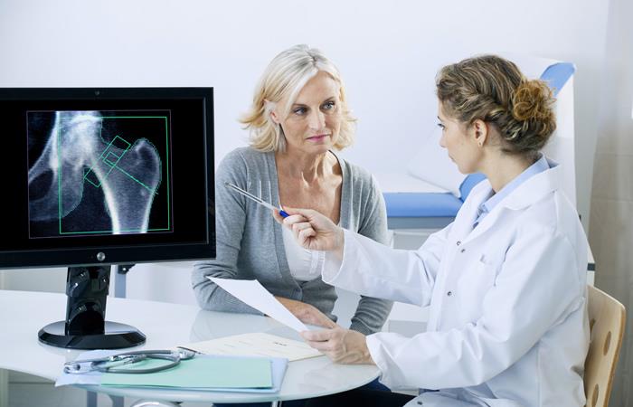 La osteoporosis es una enfermedad que adelgaza y debilita los huesos. Foto: Shutterstock