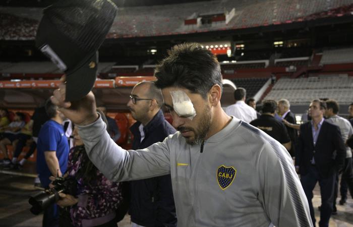 Pablo Pérez, jugador de Boca Juniors que salió con su ojo lesionado. Foto: AFP