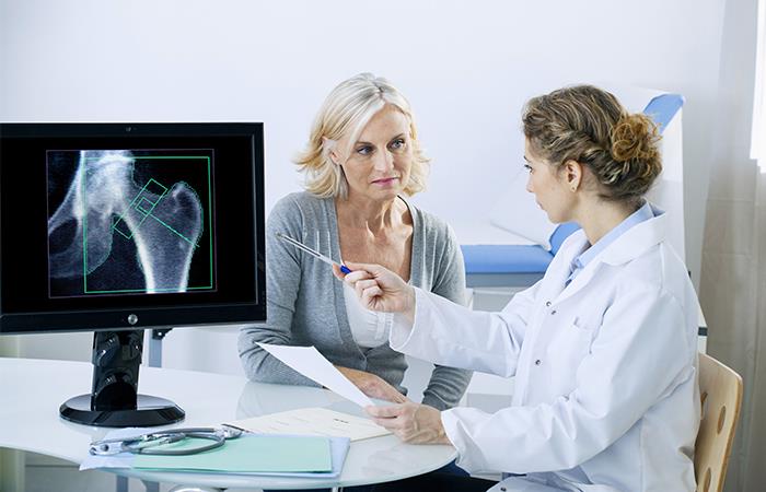 La osteoporosis es silenciosa, no presenta síntomas. Foto: Shutterstock
