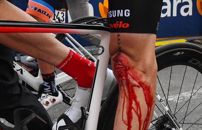 Así quedó la rodilla de Tom Dumoulin tras la caída en la cuarta etapa. Foto: EFE