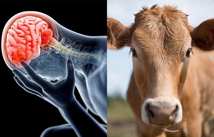 Las proteínas del cerebro humano se ven afectadas al consumir carne infectada. Foto: Shutterstock