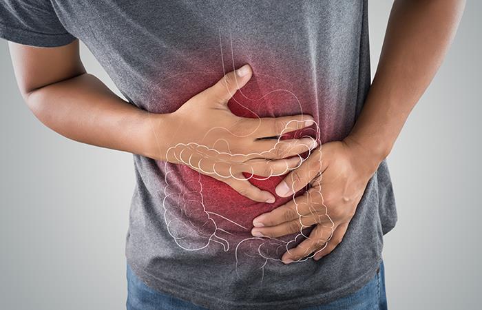 Preocupante aumento de cifras por cáncer de colon. Foto: Shutterstock