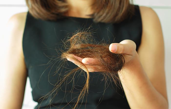 Aleja la alopecia. Foto: Shutterstock