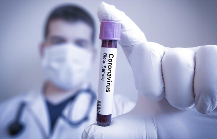 Colombianos dieron negativo en prueba de coronavirus. Foto: Shutterstock