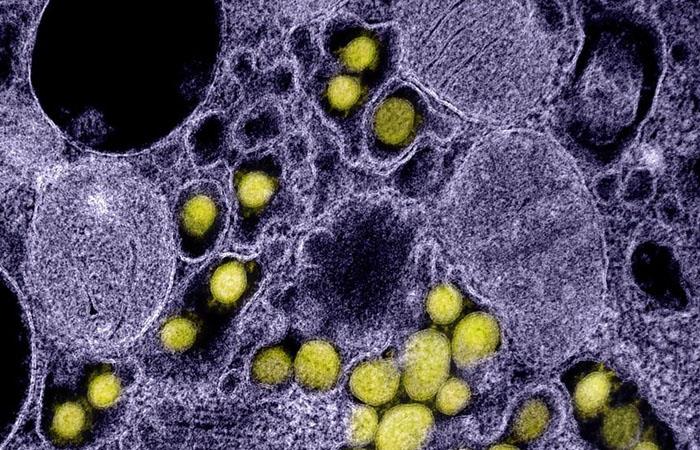 Foto microscópica del coronavirus. Foto: EFE