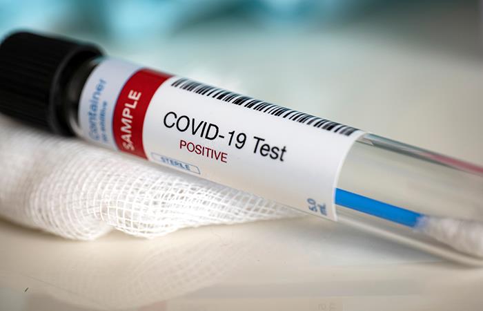 Nuevo síntoma del COVID-19. Foto: Shutterstock