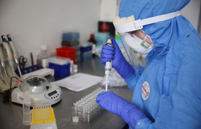 Científicos en todo el mundo están en búsqueda de la vacuna contra el coronavirus. (). Foto: EFE