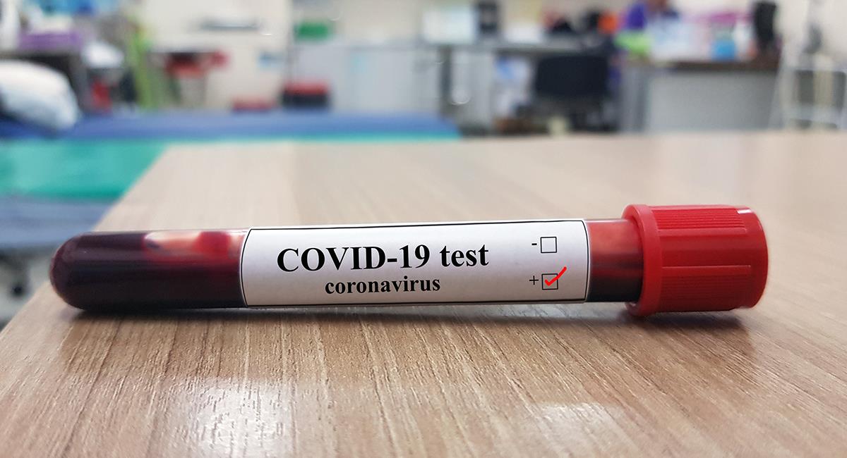 Detectan diferencias en la sangre de los infectados por coronavirus, según su gravedad. Foto: Shutterstock