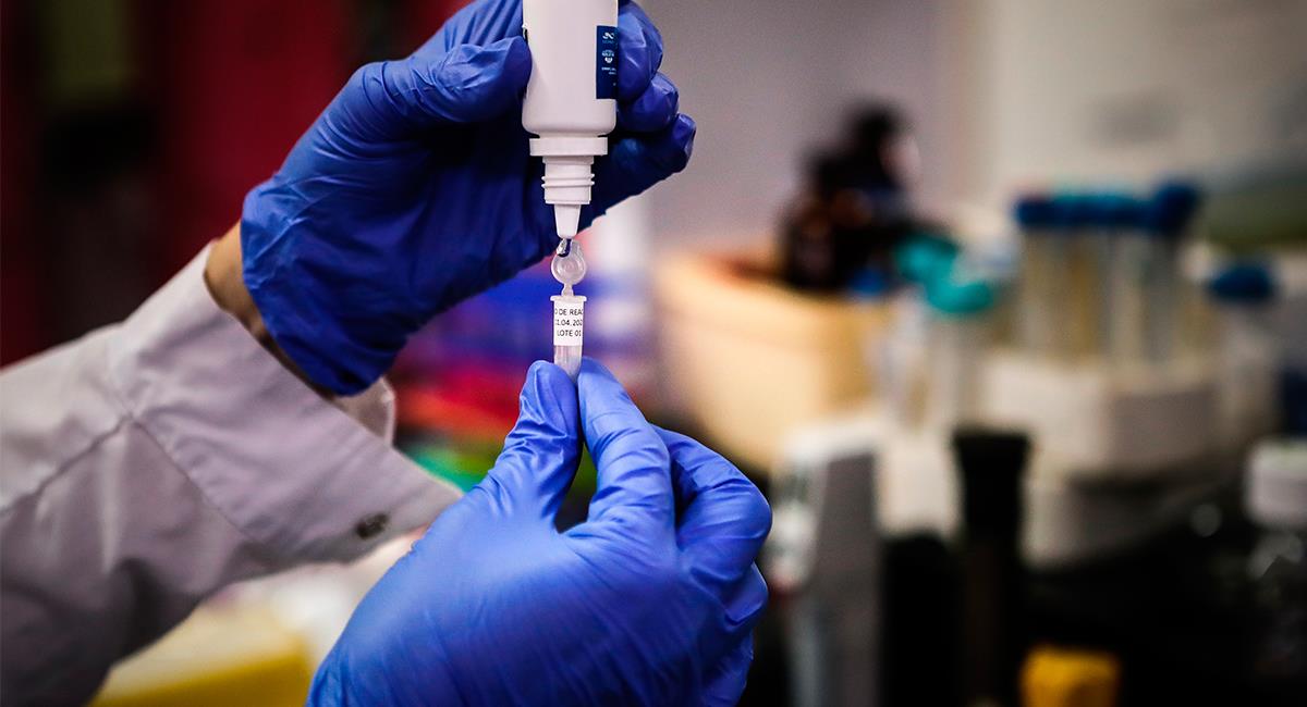 El mundo sigue buscando una vacuna para el coronavirus. Foto: EFE