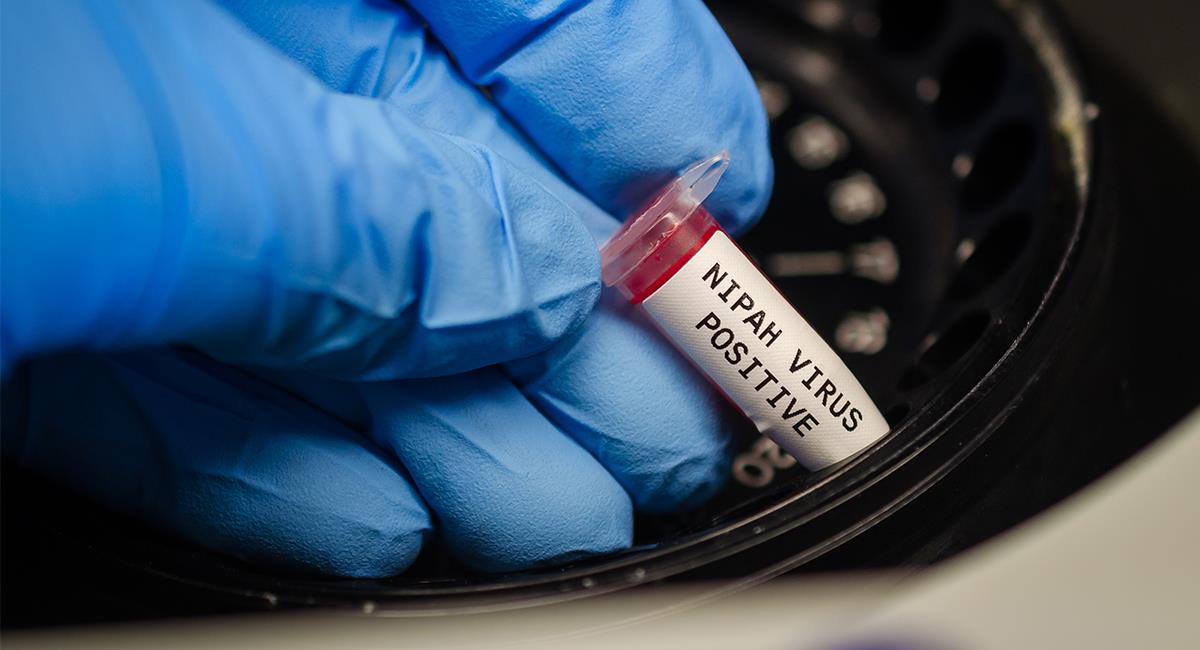 El virus Nipah fue descubierto en India y no existe cura para él. Foto: Shutterstock