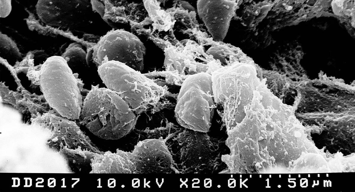 Bacteria que causa la peste bubónica. Foto: Pixabay