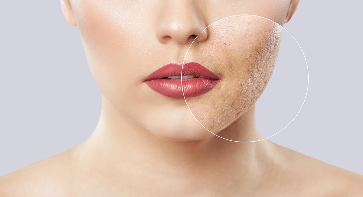 Mejora la apariencia de los poros en tu piel con algunos consejos de los expertos. Foto: Shutterstock