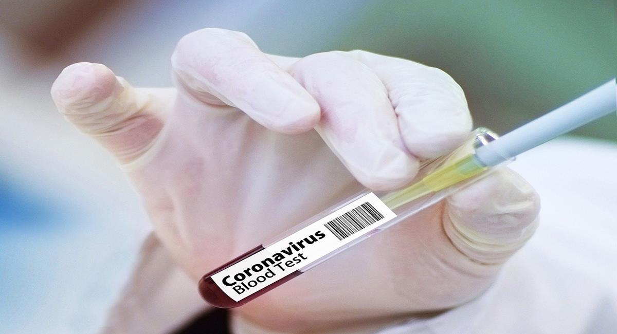 Las promesas de una vacuna contra el COVID-19 abundan pero hay que ser realistas frente al panorama. Foto: Pixabay