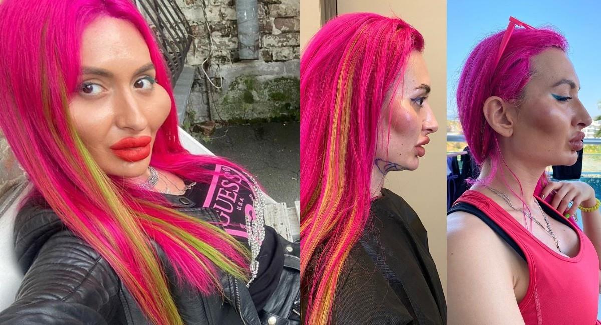 Una fotografía del antes y después de Anatassia tiene impactados a sus seguidores. Foto: Instagram