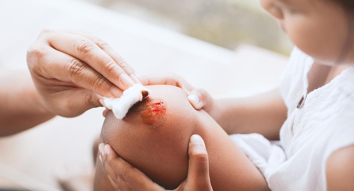 Recomendaciones de los expertos para tratar las heridas en casa. Foto: Shutterstock