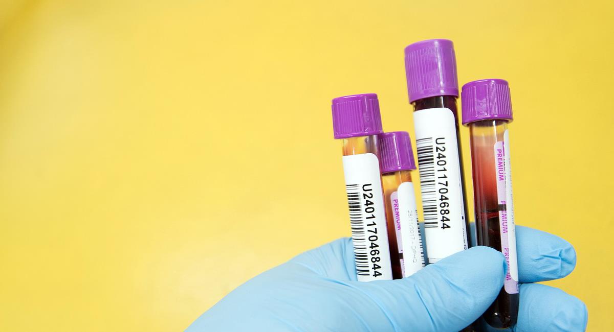 El estudio de seroprevalencia mide si existen anticuerpos en la sangre, lo cual indica exposición a un virus. Foto: Pixabay