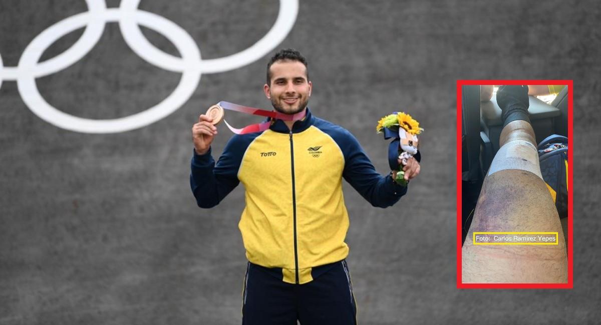 Carlos Ramírez ganó la medalla de bronce lesionado. Foto: Twitter Prensa redes Comité Olímpico Colombiano.
