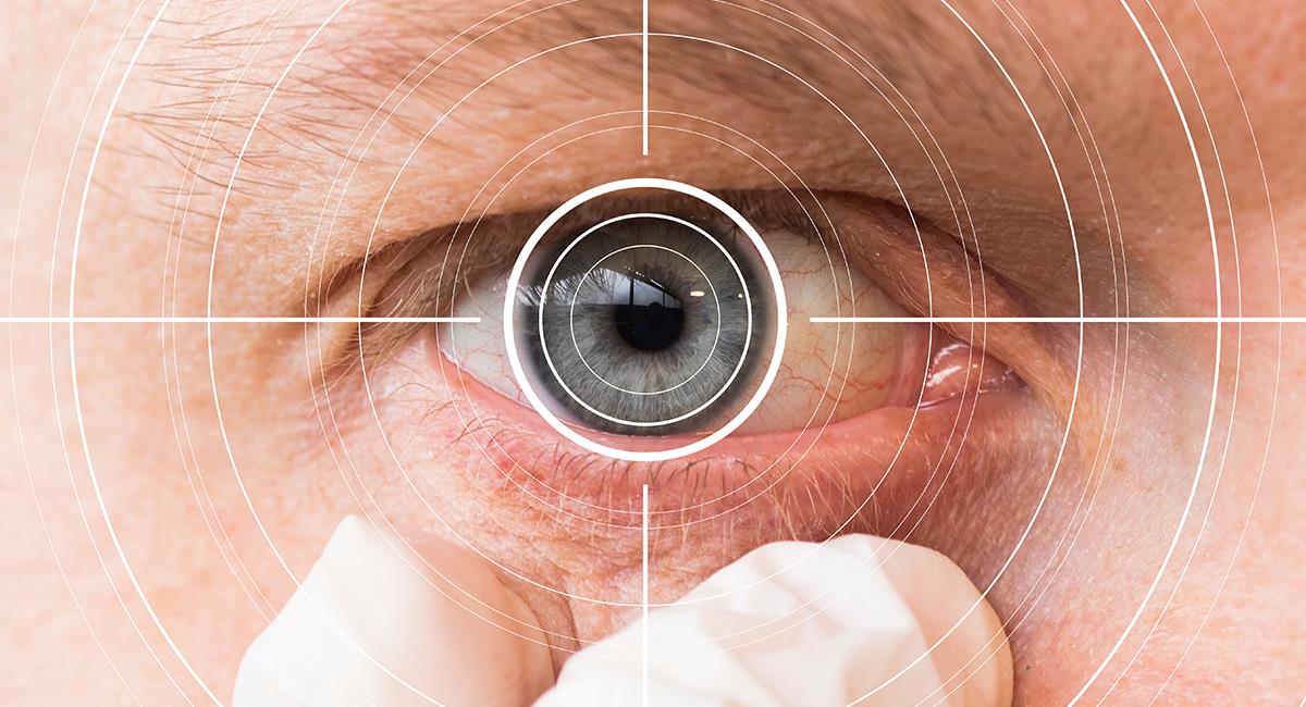 Salud visual: 3 tips de los expertos para cuidar tus ojos. Foto: Shutterstock