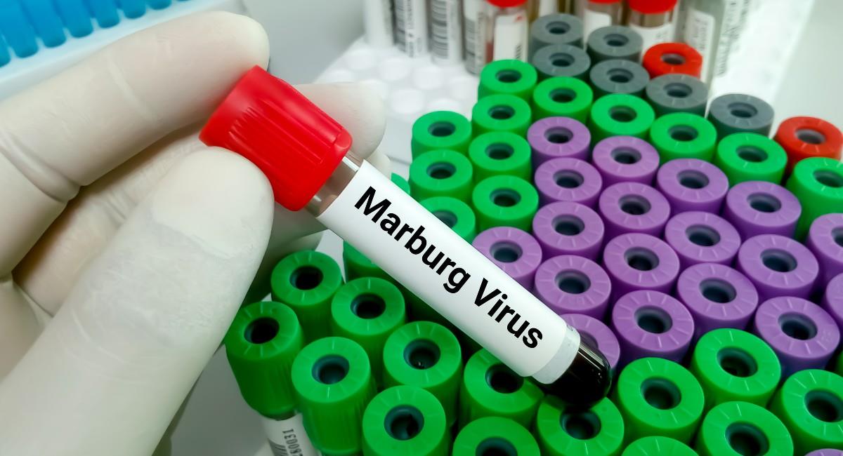 El virus tiene un periodo de incubación de 2 a 21 días. Foto: Shutterstock