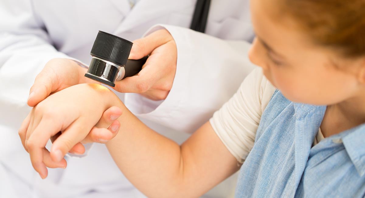 Expertos te enseñan a identificar o prevenir el cáncer de piel. Foto: Shutterstock