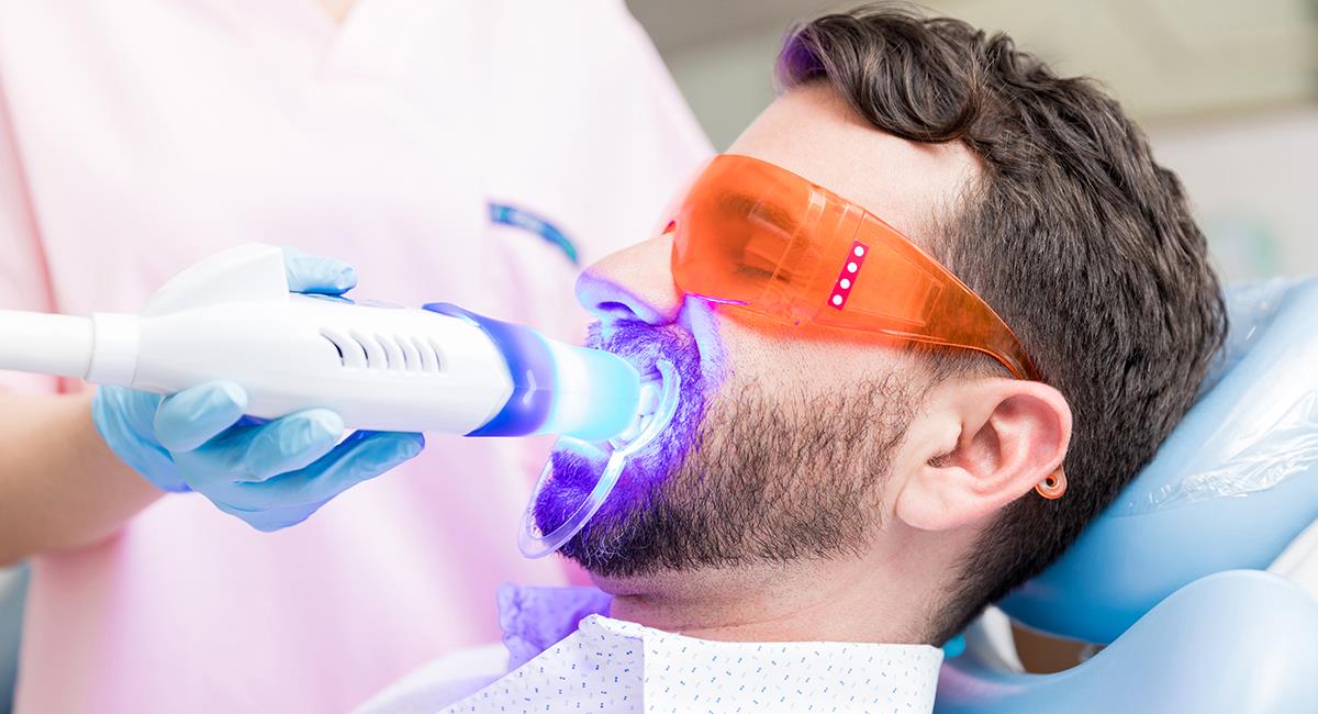 Verdad o mito: todo lo que debes saber sobre los blanqueamientos dentales. Foto: Shutterstock