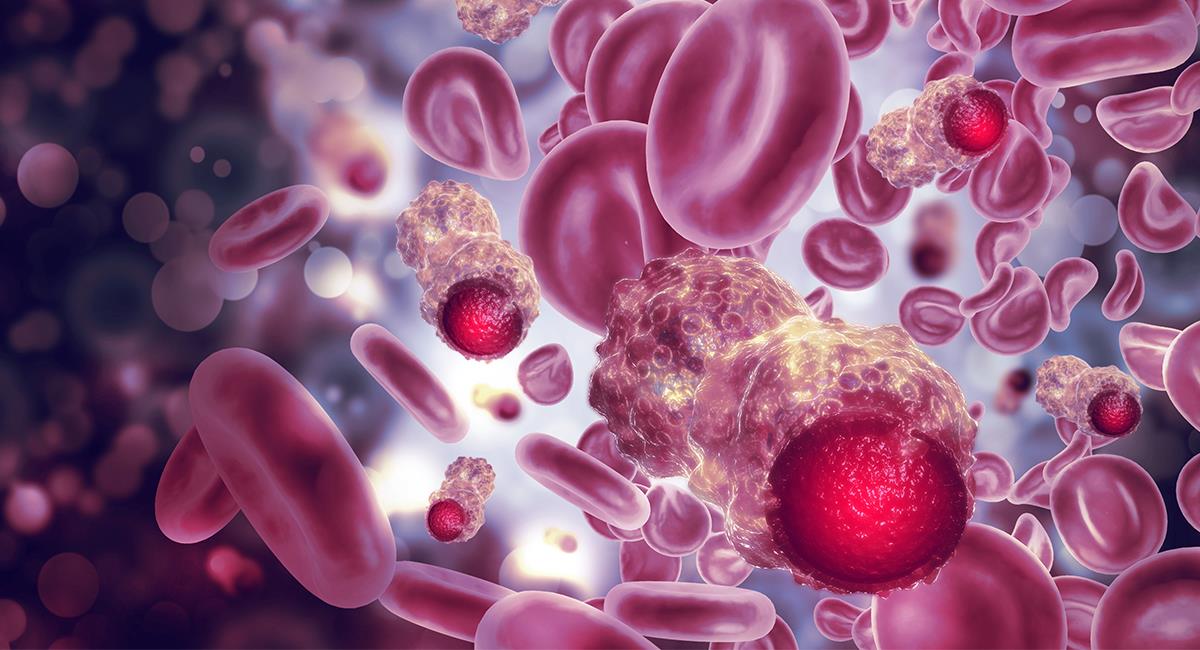 Cuidado, se podría padecer cáncer en la sangre sin llegar a notarlo. Foto: Shutterstock