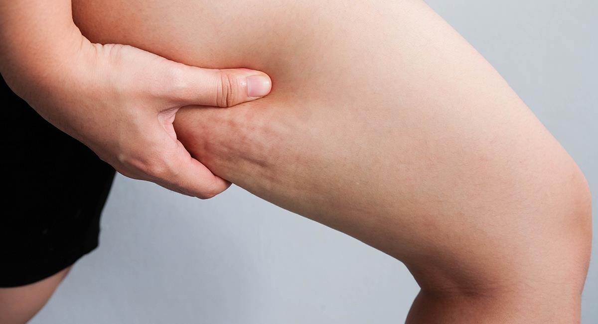 5 ejercicios para acabar con la celulitis que tienes en tus piernas. Foto: Shutterstock