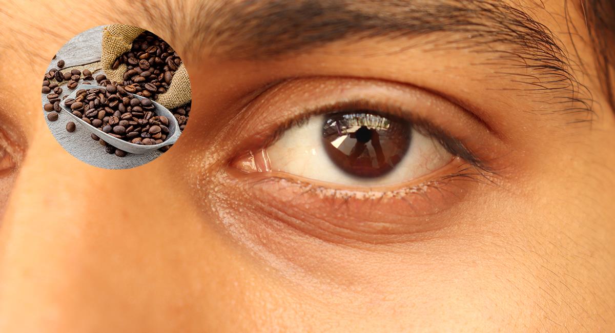 Poderosa mascarilla de café para eliminar las molestas ojeras. Foto: Shutterstock