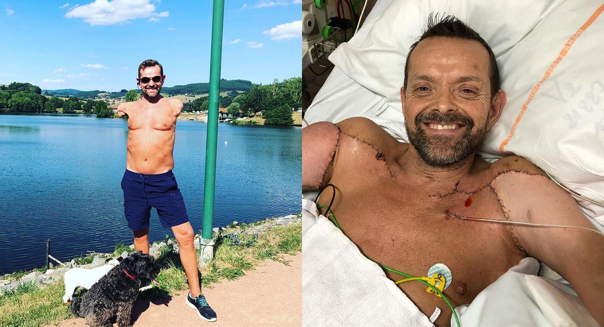 Así vive ahora Félix, el primer hombre con un trasplante de brazos. Foto: Instagram @felix_gretarsson