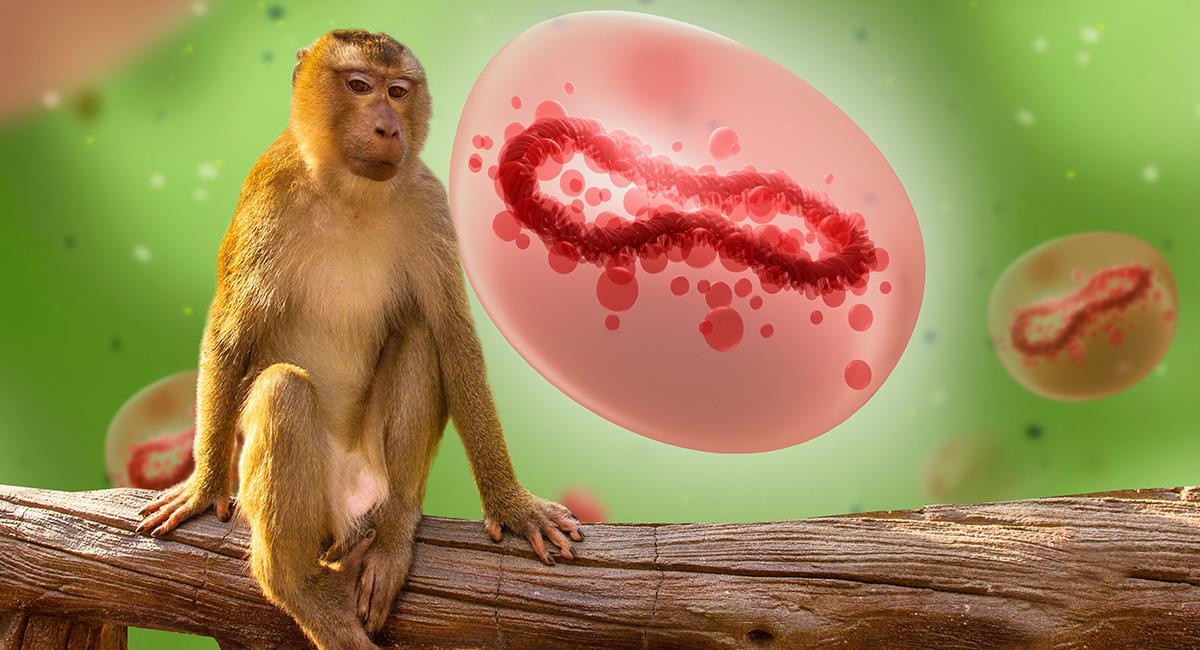 Viruela del mono: 7 consejos de los expertos para evitar contagios. Foto: Shutterstock