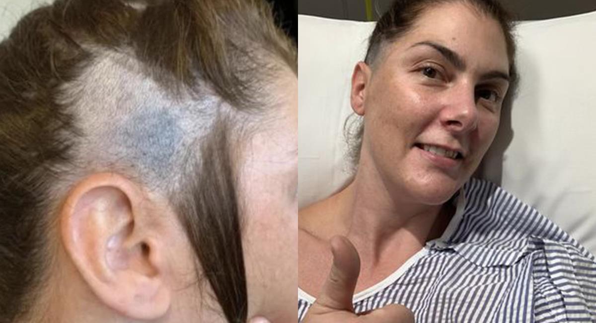 “Un corte de pelo me salvo la vida”: mujer fue al estilista y descubrió una extraña mancha. Foto: Mirror