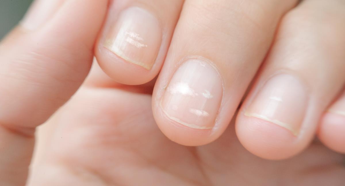 Mira cómo lucen tus uñas y sabrás qué enfermedad podrías padecer. Foto: Shutterstock