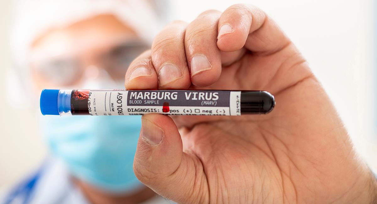 OMS enciende las alarmas por nuevo virus que es tan mortal como el ébola. Foto: Shutterstock