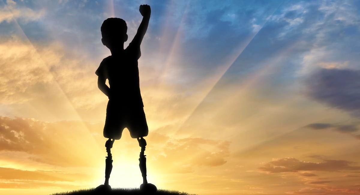 Desde que tenía un año y medio ,el menor usa una prótesis, puesto que nació sin pierna debido a una deficiencia congénita en su miembro derecho. Foto: Shutterstock