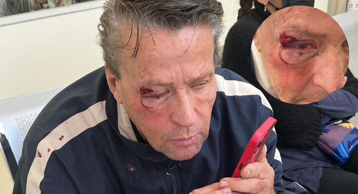 Brutal ataque a Alfredo Adame. Foto: Instagram @adamereacciona