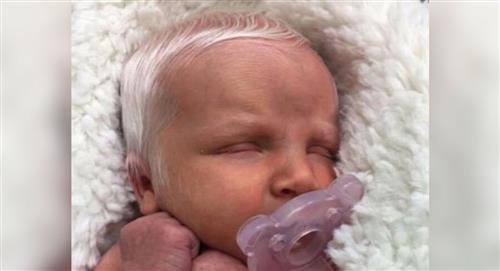 La bebé con cabello blanco que es viral en redes sociales