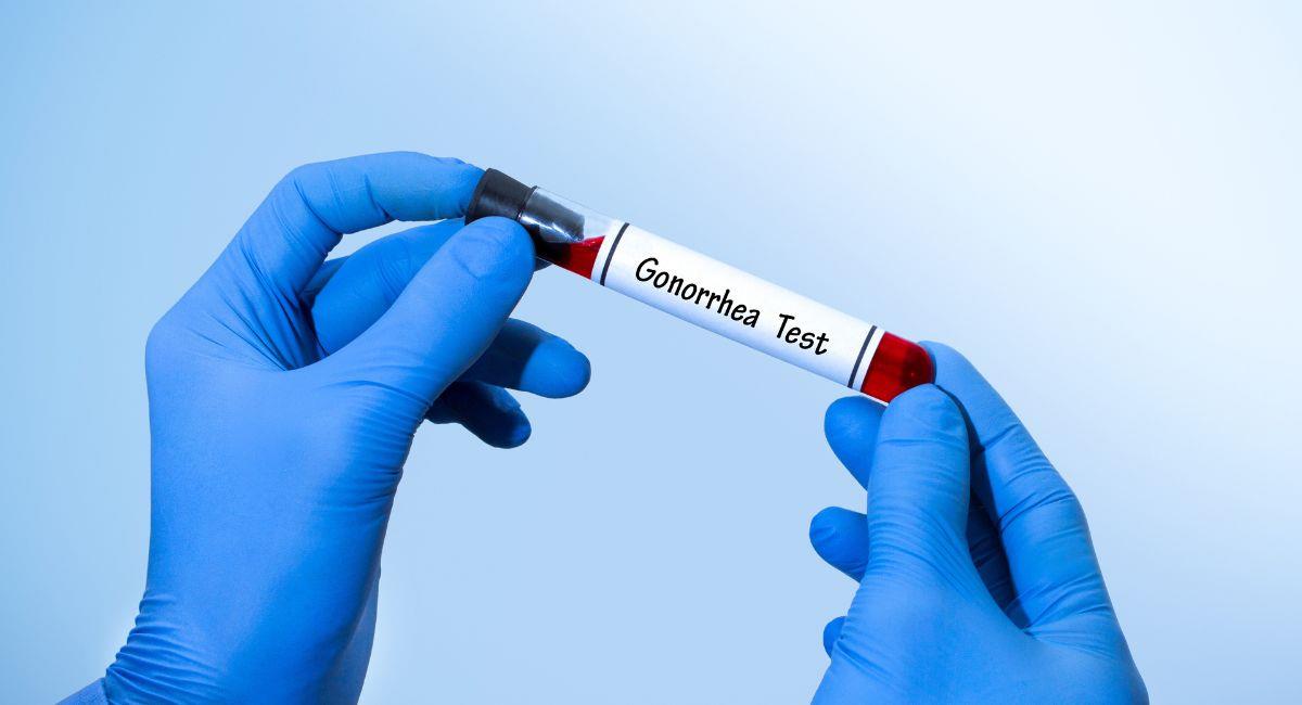 Nueva cepa de gonorrea preocupa a las autoridades en Estados Unidos. Foto: Shutterstock