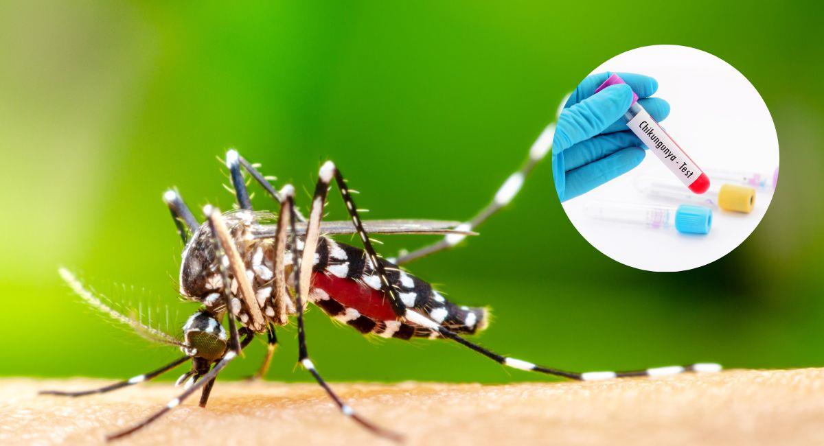 Así puede identificar si una persona padece Chikungunya. Foto: Shutterstock