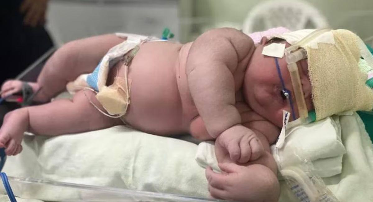 Nace “bebé gigante” en Brasil. Foto: Facebook Hospital Padre Colombo